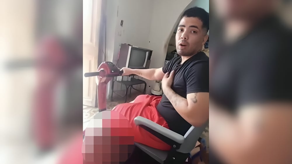 Joven cubano con elefantiasis recibe una Scooter donada por compatriotas en Miami (1)