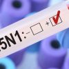 Gripe H5N1