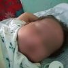 Bebé cubano fallece tras confusión de su enfermedad en hospital de Villa Clara