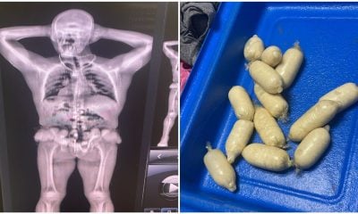 Aduana de Cuba detecta entrada de droga adosada al cuerpo de un viajero