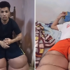 Joven cubano con linfedema