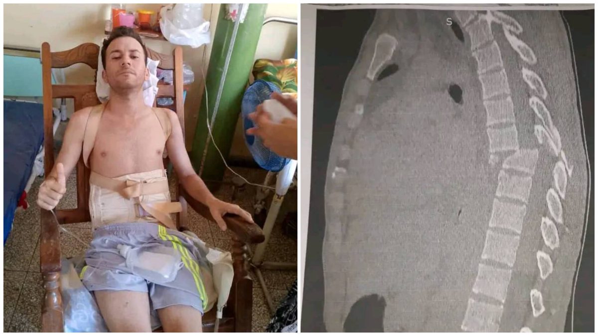 Joven cubano en cama por lesión en la columna