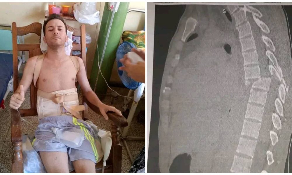 Joven cubano de 28 años pierde la movilidad tras accidente y solicitan ayuda de la comunidad