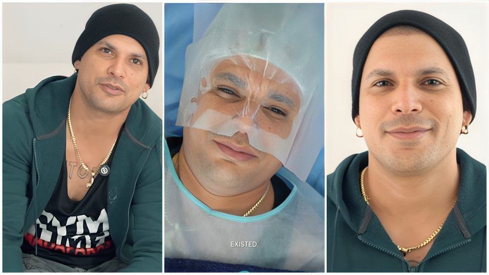Ultrack se cambia el color de ojos
