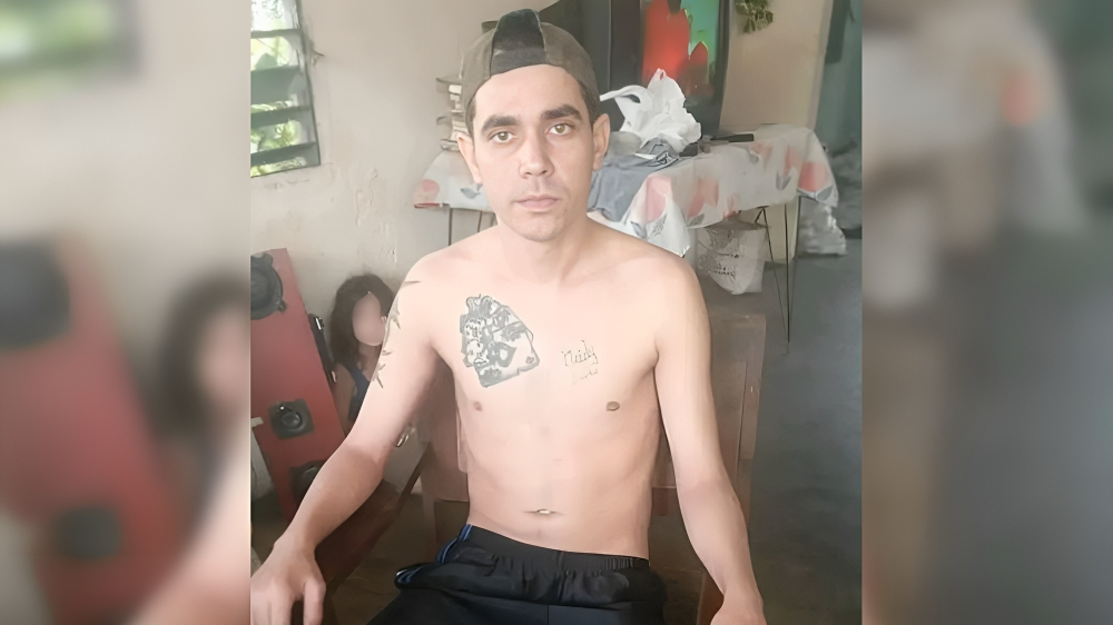 Cubano perdió una pierna y ahora pide esta ayuda para salir adelante “solo quiero ser útil” (1)