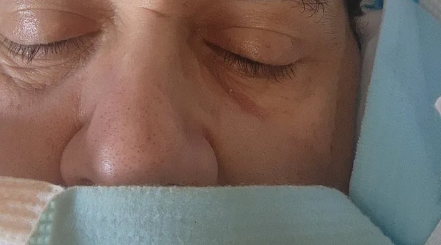 Cubano pide ayuda por primera vez tras una operación de urgencia