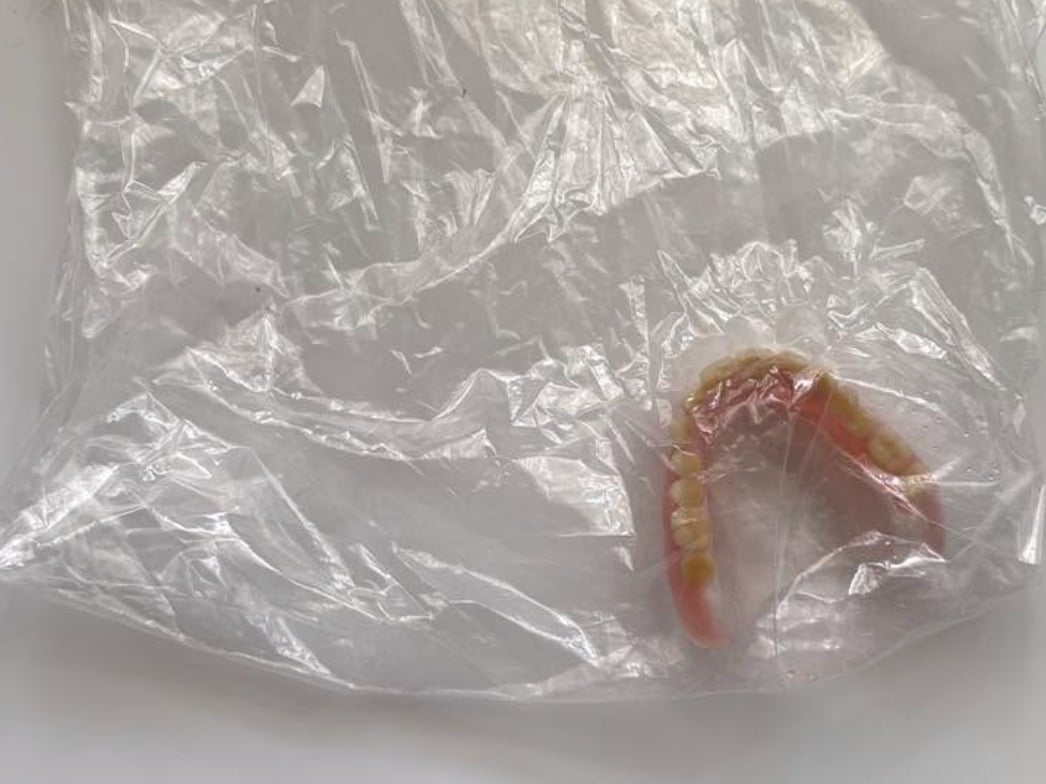 Insólito hallazgo en una maleta llegada de Cuba a Miami: una dentadura postiza