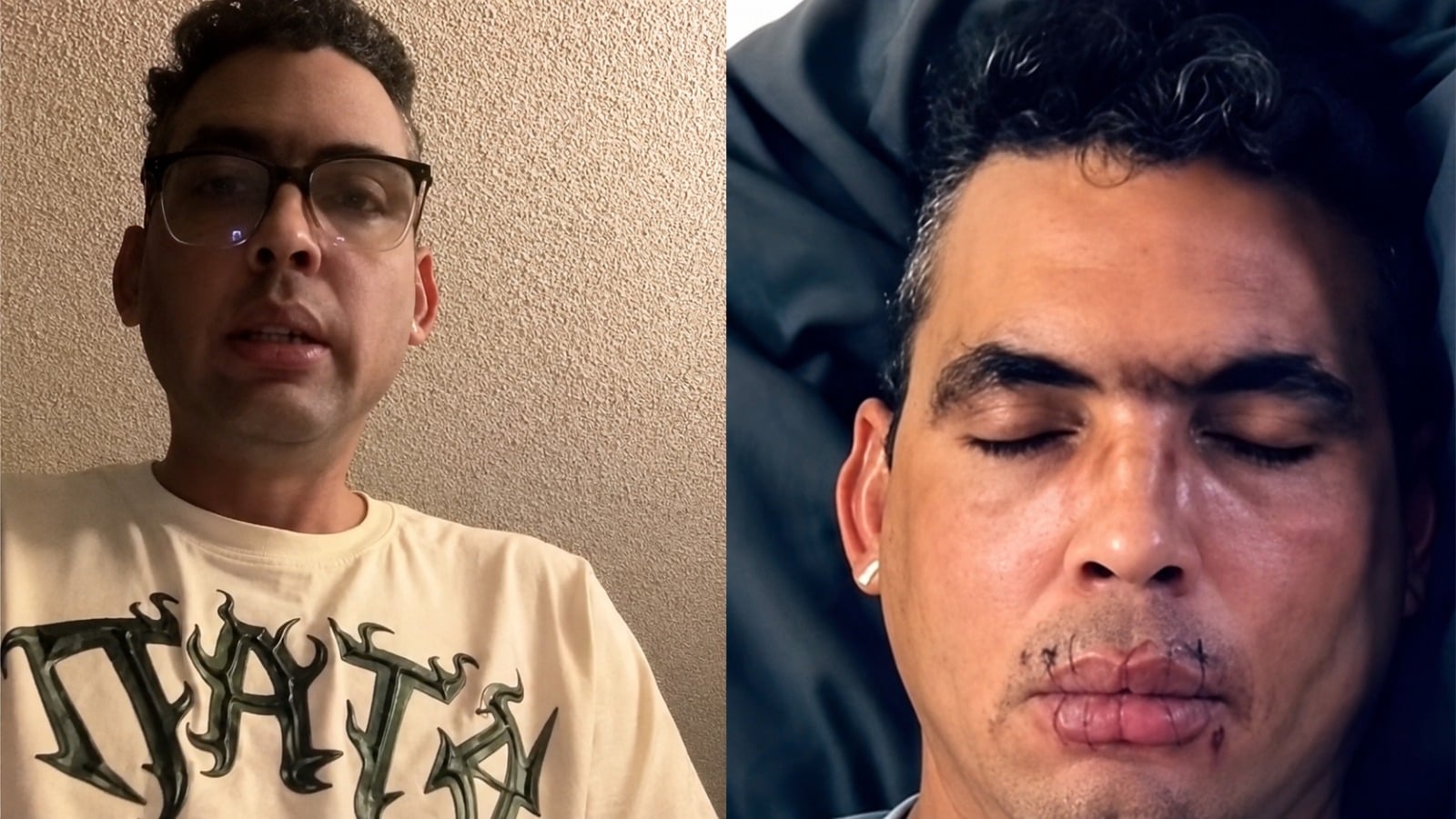 Cubano con I-220A se cose la boca y exige frenar las deportaciones de ICE